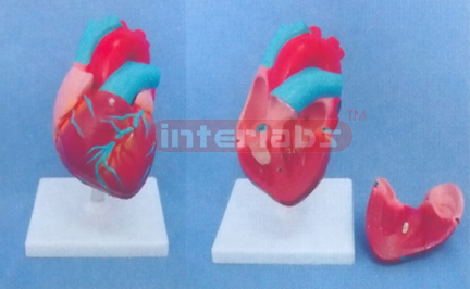 SMALL MIDDLE HEART MODEL, 1.25X